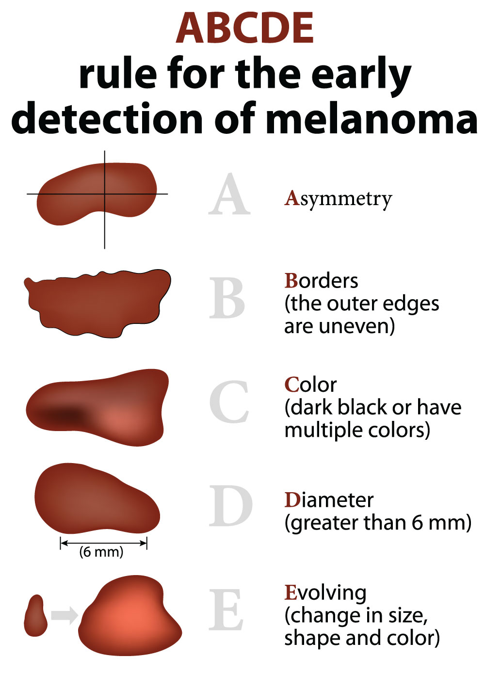 melanoma detection